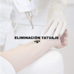 ELIMINACON TATUAJE "S"