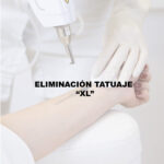 ELIMINACION TATUAJE "XL"