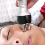 RADIOFRECUENCIA FACIAL