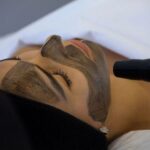 HOLLYWOOD PEEL (3 SESIONES)
