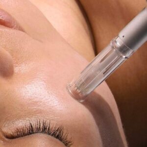 DERMAPEN (3 SESIONES)